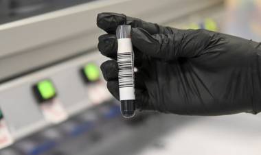 Estudios genéticos de cáncer: Santa Fe es la única provincia que los garantiza en la salud pública y se posiciona como referente nacional